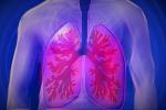 Jornada de Detección Temprana de Hipertensión Pulmonar